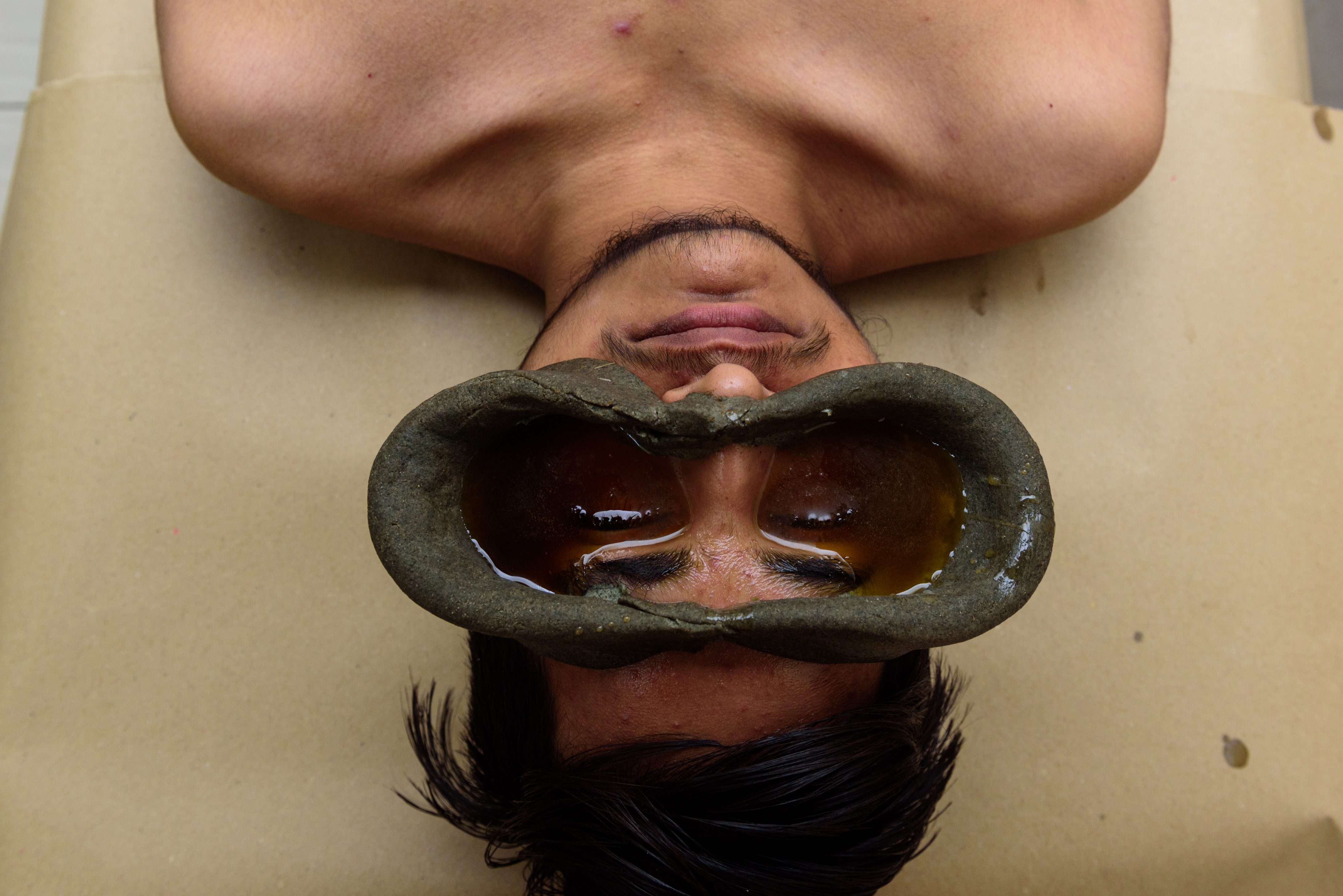 Akshitarpan Therapy